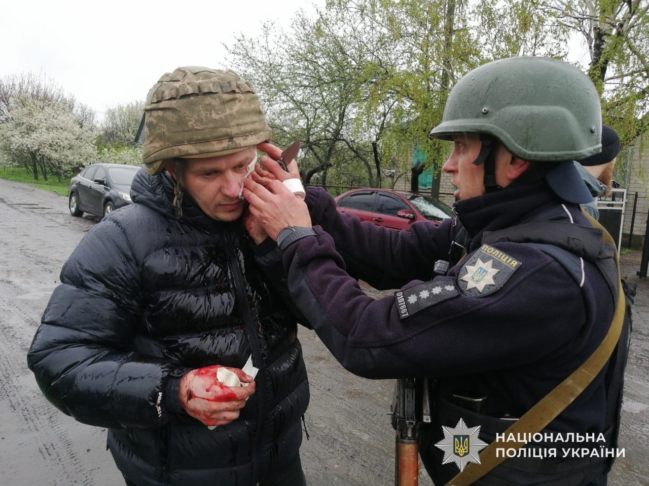На Дніпропетровщині чоловік кинув гранати у поліцейських під час затримання: поранені п’ятеро правоохоронців | Прихист На Дніпропетровщині чоловік кинув гранати у поліцейських під час затримання: поранені п’ятеро правоохоронців | Прихист